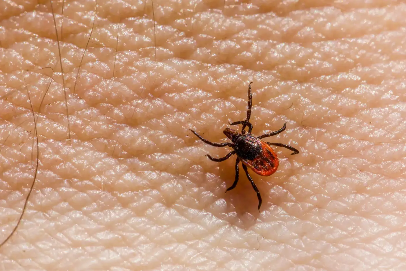 Tick on human skin, close up
